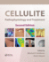 Cellulite: Pathophysiology and Treatment
