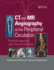 Ct and Mr Angiography of the Peripheral Circulation