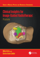 Clinical Insights for Image-Guidance Radiation Therapy: Prostate