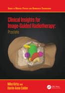 Clinical Insights for Image-Guidance Radiation Therapy: Prostate