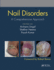 Nail Disorders a Comprehensive Approach (Pb 2020)