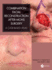 Combination Facial Reconstruction After Mohs Surgery a Case Based Atlas (Hb 2024)