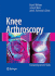 Knee Arthroscopy