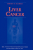 Liver Cancer (Md Anderson Solid Tumor Oncology Series)