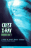Chest X-Ray Made Easy