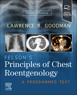 Felson's Principles of Chest Roentgenology, a Programmed Text
