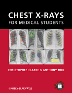 Chest X-Rays for Medical Students