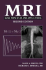 Mri: Basic Principles and Applications