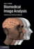 Biomedical Image Analysis