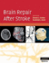 Brain Repair After Stroke