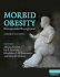 Morbid Obesity: Peri-Operative Management