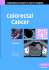 Colorectal Cancer