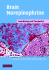 Brain Norepinephrine: Neurobiology and Therapeutics