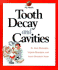 Tooth Decay and Cavities