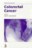 Challenges in Colorectal Cancer