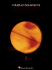 "Coldplay": "Parachutes" (Pvg)