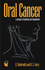 Oral Cancer: a Synopsis of Pathology and Management
