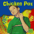 Chicken Pox (First Facts)