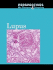 Lupus (Perspectives on Diseases and Disorders)