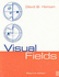 Visual Fields