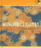 Mononucleosis (Health Alert)