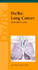 Dx/Rx: Lung Cancer