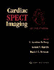 Cardiac Spect Imaging
