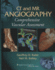 Ct and Mr Angiography: Principles, Techniques and Applications for Cardiovascular Imaging: Comprehensive Vascular Assessment Rubin, Geoffrey D. and Rofsky, Niel M.