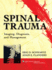 Spinal Trauma: Imaging, Diagnosis, and Management