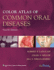 Color Atlas of Common Oral Diseases 4e: .
