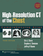 High-Resolution Ct of the Chest: Comprehensive Atlas