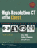 High-Resolution Ct of the Chest: Comprehensive Atlas