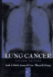 Lung Cancer
