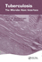 Tuberculosis: the Microbe Host Interface