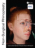 Non Surgical Rhinoplasty (Hb 2023)