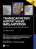 Transcatheter Aortic Valve Implantation Current and Future Developments 2ed (Hb 2025)