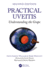 Practical Uveitis: Understanding the Grape
