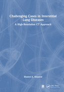 Challenging Cases in Interstitial Lung Diseases: A High-Resolution CT Approach
