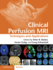 Clinical Perfusion Mri: Techniques and Applications