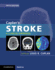 Caplan's Stroke