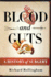Blood and Guts: a History of Surgery