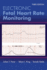 Electronic Fetal Heart Rate Monitoring: The 5-Tier System: The 5-Tier System