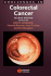 Challenges in Colorectal Cancer
