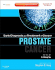 Prostate Cancer
