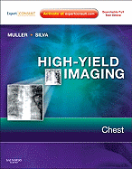 High-Yield Imaging: Chest: Expert Consult-Online and Print