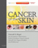 Cancer of the Skin: Expert Consult-Online and Print