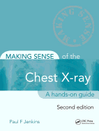 Making Sense of the Chest X-Ray: a Hands-on Guide