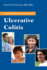 Questions and Answers About Ulcerative Colitis