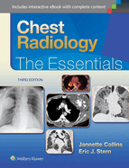 Chest Radiology: the Essentials (3rd Edn)