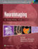 Neuroimaging a Teaching File (Pb 2015)